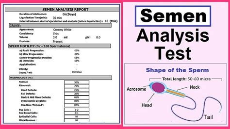 sperm count chart|Semen Analysis .